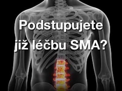 lecba sma video