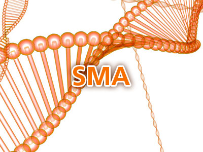 sma